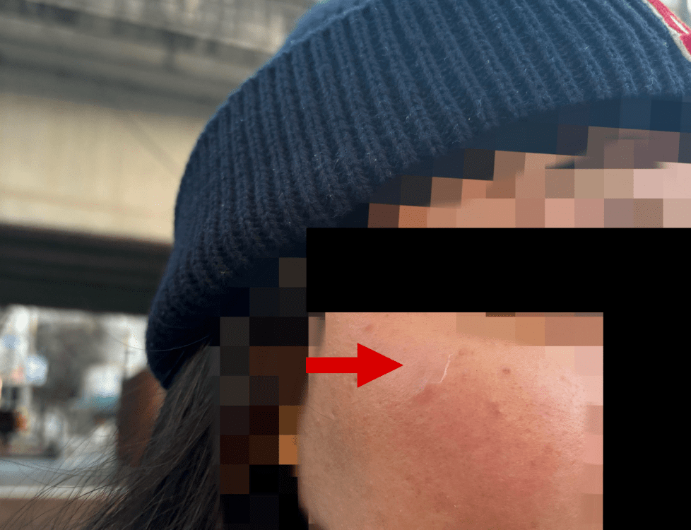 突发！新加坡女子在韩国被陌生人挥拳重重袭击！新加坡会排外吗？